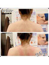 ラディエンス 多治見店/もっこり肩改善