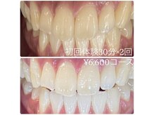 ホワイトニングルーム 横浜店(Whitening Room)/ホワイトニング/横浜