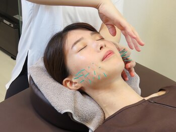 グッドビューティー(GOOD BEAUTY)/美容鍼で小顔&リフトアップ