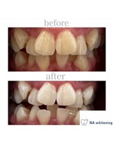 エヌエーホワイトニング たまプラーザ店(NAホワイトニング)/セルフホワイトニング/横浜