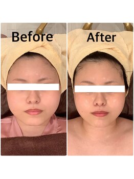 スペチアーレ 夙川/美顔革命★