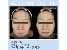 アンジェラックス スキンケアセンター 渋谷/まずはご相談ください！