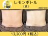 【腰】脂肪分解!!レモンボトルを微細孔から導入＆EMSで引き締め!!