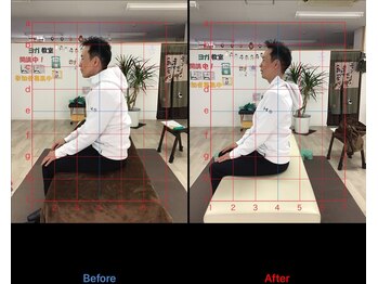 ストレチックス 近江八幡店/BeforeAfter