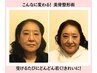 【人気No.1】たるみ改善V字フェイスライン美骨矯正×ポテンツァ×脂肪燃焼