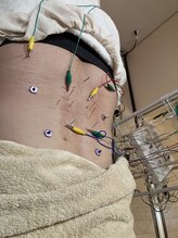 瑞 鍼灸院/腰痛ケア鍼灸/男性は紹介で可