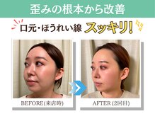 ナチュラルパーフェクトフェイス 新宿/ビフォーアフター写真