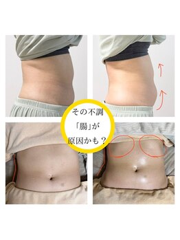 カルム(calme)の写真/【心と身体を深くリセットしませんか?】腸活×腸セラピーで身体の内側からケア♪女性の不調も改善◎