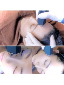 お肌をきれいにしたい