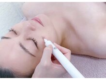 サニー(SUNNY)の雰囲気（シミケアでクリアな素肌へ★熱くない/痛みが少ない/跡にならない）