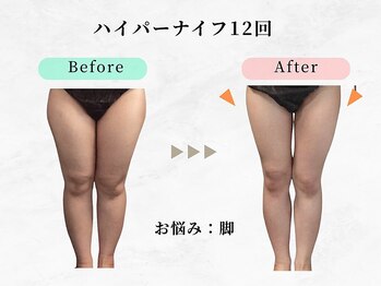 美容整体 ウェリナ 蟹江院/小顔矯正/骨盤矯正/痩身整体