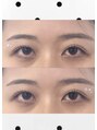 アイオンミー 心斎橋店(EYE on ME) 根元から立ち上げて、ぱっちりなお目元に☆