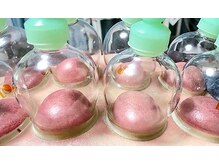 スピロソフィア/カッピング