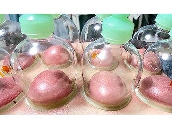 スピロソフィア/カッピング