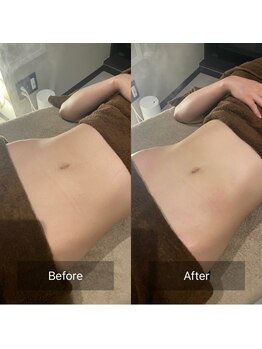 マル(MARU)/腸もみでむくみウエストスッキリ