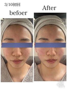 リッチベル(richbelle)/