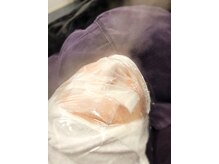 ビースキン(B SKIN)