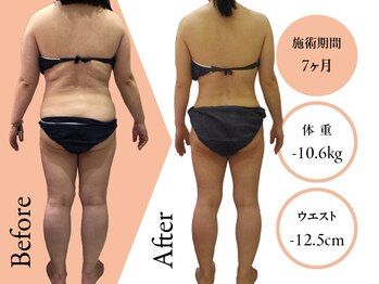 クリニカルエステ イーズ 京橋店/痩身Before-After