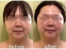 サロンハート(Salon Heart)/コルギ×ハイパーナイフ