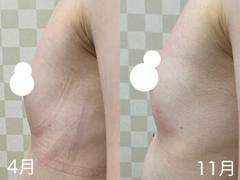 ハレオラ(HaleOla)/30代☆細身さんの育乳♪