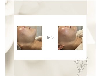 サロン アンド ヨガ マリカ(mallika)/