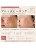 【跡・毛穴・ニキビケア】マイクロニードルピーリング◎18000⇒16500/越谷