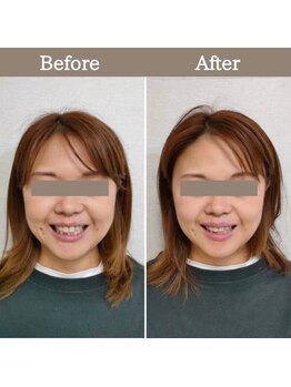 シェア 人形町店(Chare)/【小顔・骨盤矯正・О脚・整体】