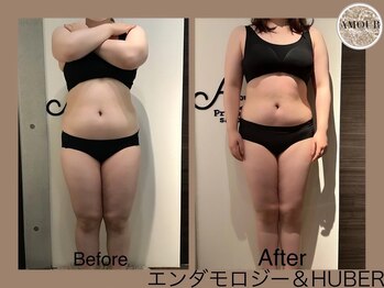 アムール 麻布十番(Amour)/エンダモロジー&HUBER