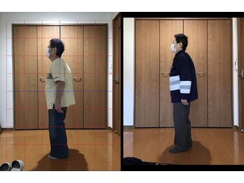 整体院 望夢/自分の足で歩けるようになった◎