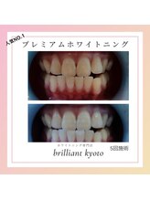 ブリリアント 京都店(Brilliant)/専門家と提携メニューあり◎