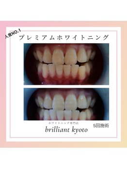 ブリリアント 京都店(Brilliant)/専門家と提携メニューあり◎