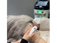 エトワール(etoile)の雰囲気（大人気の脇脱毛！初回と2回目まで1000円で施術ができます♪）