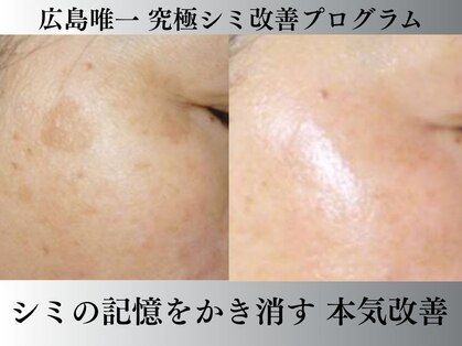 プレナ(PLENA)の写真
