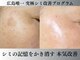 プレナ(PLENA)の写真