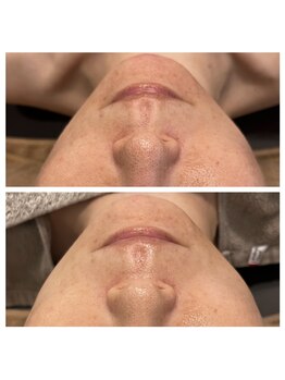 美温(mion)/おまかせフェイシャル