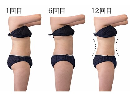 ヨサパーク メル(YOSA PARK mer)の写真