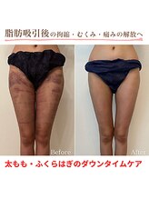 インディバ ホリ ナゴヤ ハニーズビューティー(INDIBA HORI NAGOYA Honey’s beauty)/名古屋インディバ