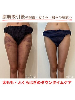 インディバ ホリ ナゴヤ ハニーズビューティー(INDIBA HORI NAGOYA Honey’s beauty)/名古屋インディバ