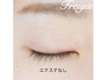 フレイヤ(Freiya)/【3D】　施術前