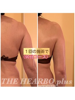 ハーボプラス(THE HEARBO plus)/90分コース