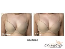 シャルムココ 蔵前店(CharmeCoCo)/お客様Before→After