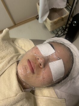 リリー(lily)/ニキビのケアに