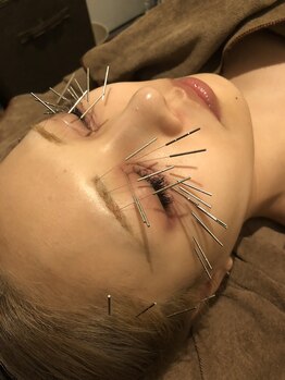 サロンリーナ 銀座店(SalonLena)/美容鍼