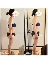 真(sin)/2回の施術で