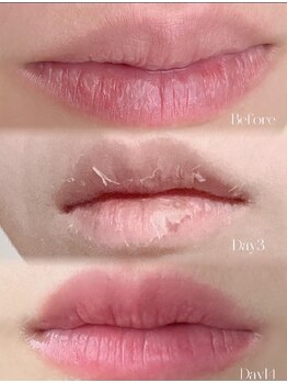 エルサ(Elsa)/ローマピンク