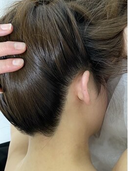 アプロディタの写真/【部分脱毛3,300円～】涼しくなってくる季節が脱毛スタートのチャンス◎気になる部分を徹底ケア♪