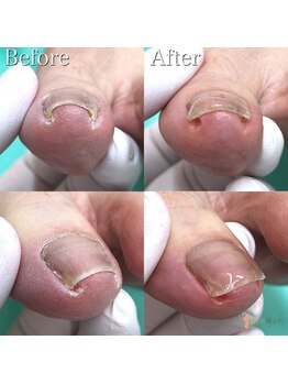 巻き爪補正店 鎌倉大船店/