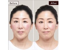 アナスタシア ミアレ 博多阪急の雰囲気（20代～60代まで幅広い年代のお客さまがいらっしゃいます#眉）