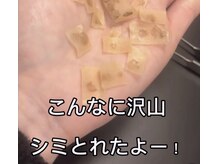 ジブラ(GEBRA)の雰囲気(【ホワイトラボ】7日間でシミケア完了!)