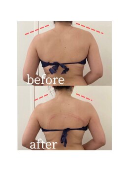 ボーレーヴ(beau reve)/ブライダル/インディバ/痩身